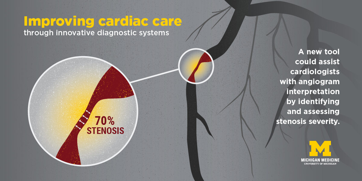 A new tool could assist cardiologists with angiogram interpretation.