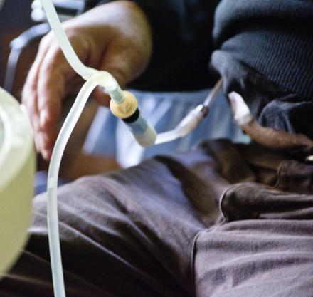 Dialysis